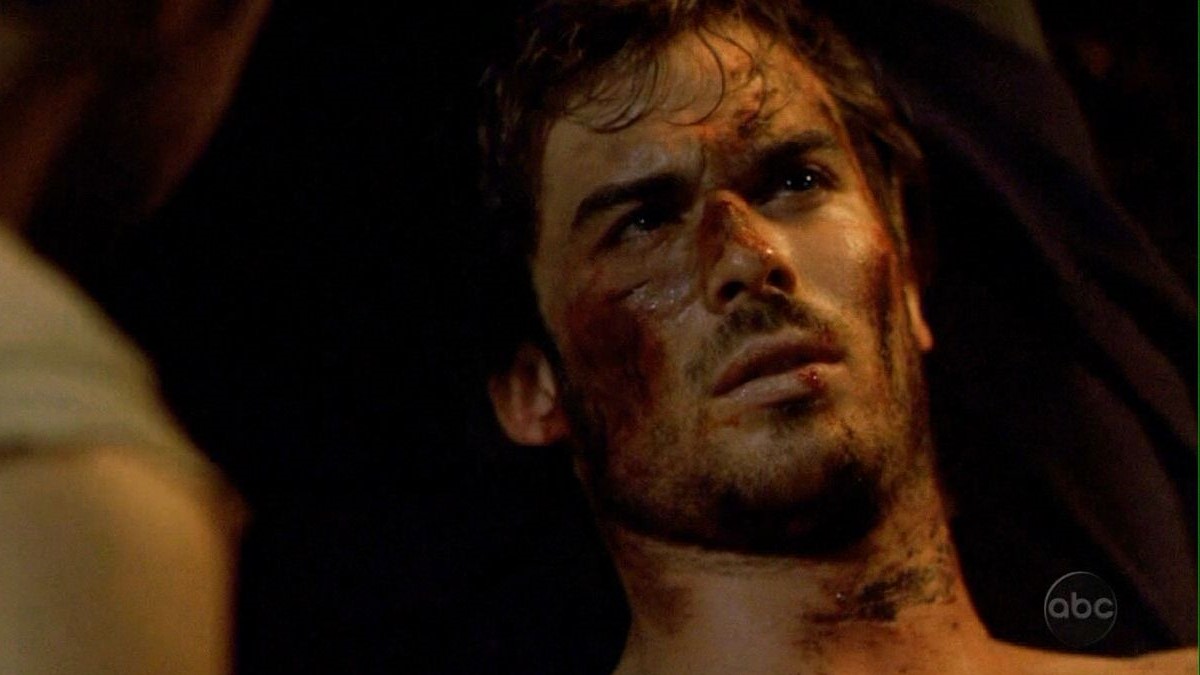 Ian Somerhalder as Boone in a scene from ABC's 'Lost.' He is a young, white man with shaggy dark hair. His face is covered in blood and bruises as he lies on the ground.